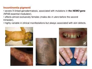 PPT Incontinentia Pigmenti PowerPoint Presentation Free Download 