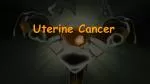 Uterine Cancer - slide 1