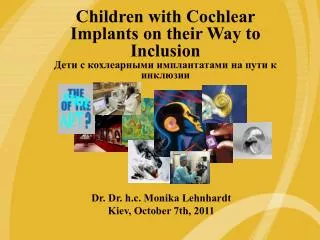 The Freedom Cochlear Implant: Another Innovation from Cochlear