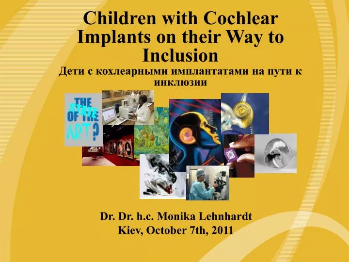 the freedom cochlear implant another innovation from cochlear