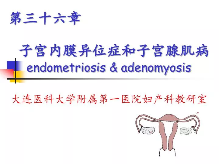 endometriosis adenomyosis