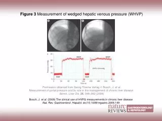 Figure 3 Measurement of wedged hepatic venous pressure (WHVP)