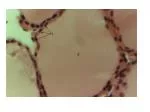 Colloid containing thyroglobulin / Stored thyroid hormone - slide 1