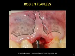 rog en flapless