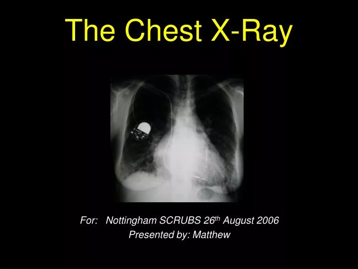 the chest x ray