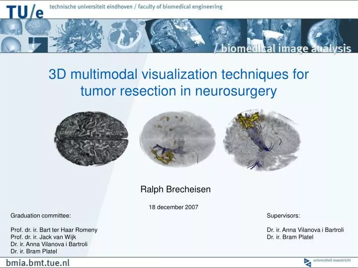 3d multimodal visualization techniques for tumor resection in neurosurgery