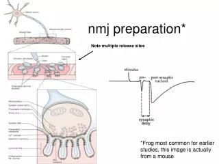 nmj preparation*