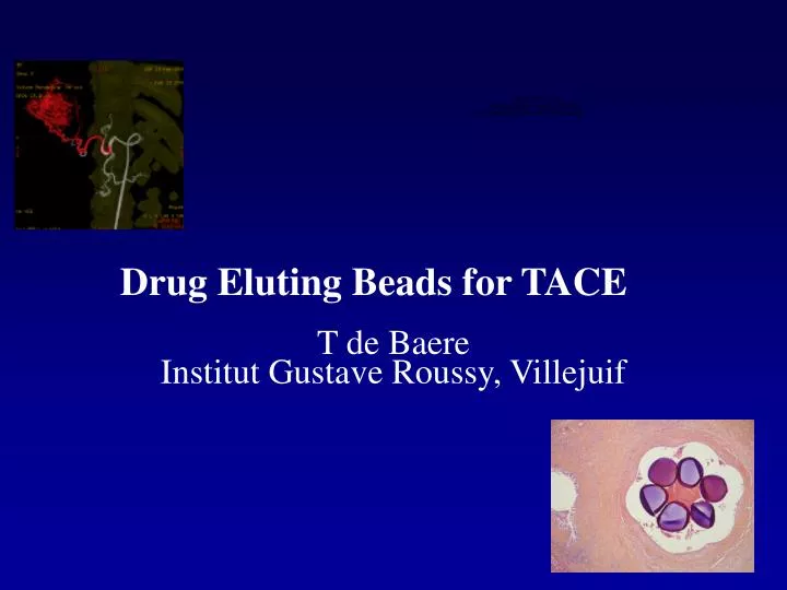 drug eluting beads for tace