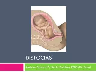 distocias