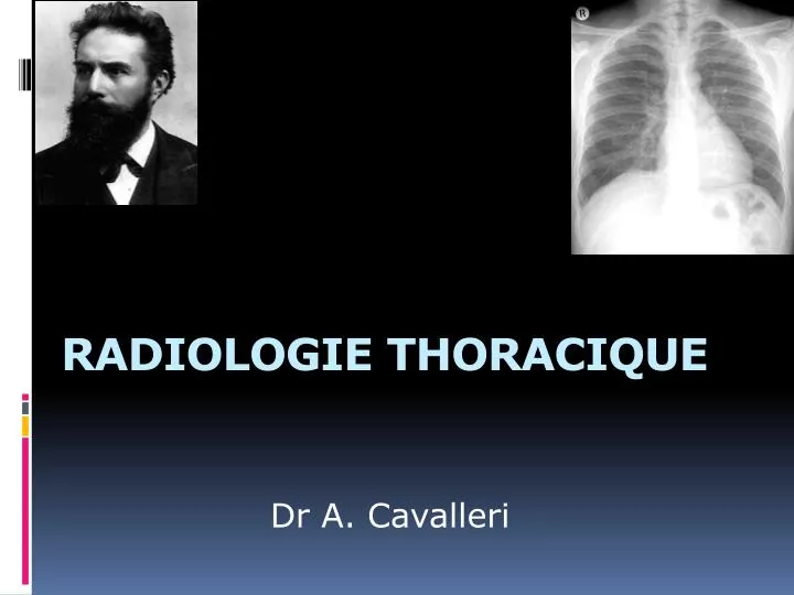 radiologie thoracique