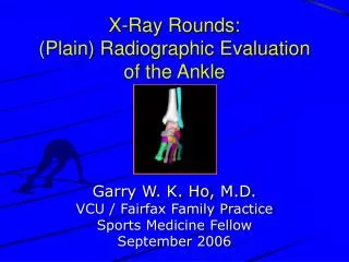 X-Ray Rounds: (Plain) Radiographic Evaluation of the Ankle