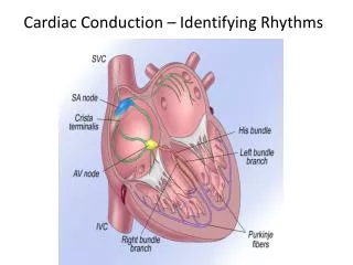 Cardiac Conduction – Identifying Rhythms