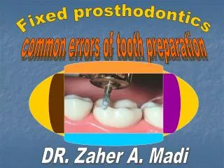 common errors of tooth preparation