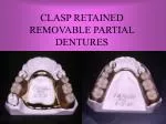 CLASP RETAINED REMOVABLE PARTIAL DENTURES