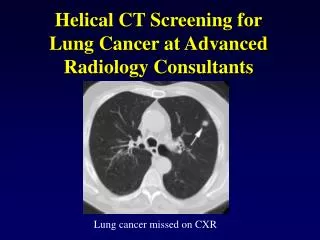 Helical CT Screening for Lung Cancer at Advanced Radiology Consultants