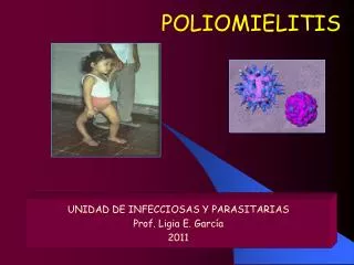 poliomielitis
