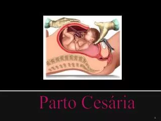 parto ces ria