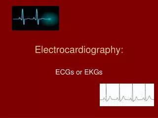 electrocardiography
