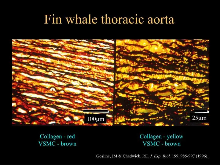 fin whale thoracic aorta