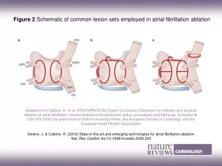 Figure 2 Schematic of common lesion sets employed in atrial fibrillation ablation