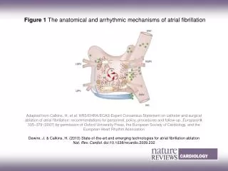 Figure 1 The anatomical and arrhythmic mechanisms of atrial fibrillation
