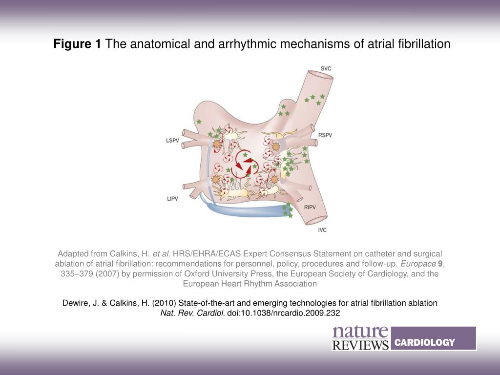 PPT - Anatomical and Arrhythmic Mechanisms of Atrial Fibrillation ...