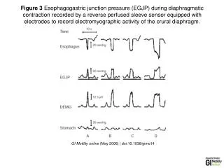 GI Motility online (May 2006) | doi:10.1038/gimo14