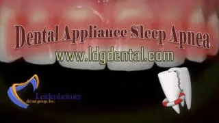 Dental Appliance Sleep Apnea