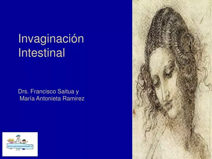 invaginaci n intestinal drs francisco saitua y mar a antonieta ramirez