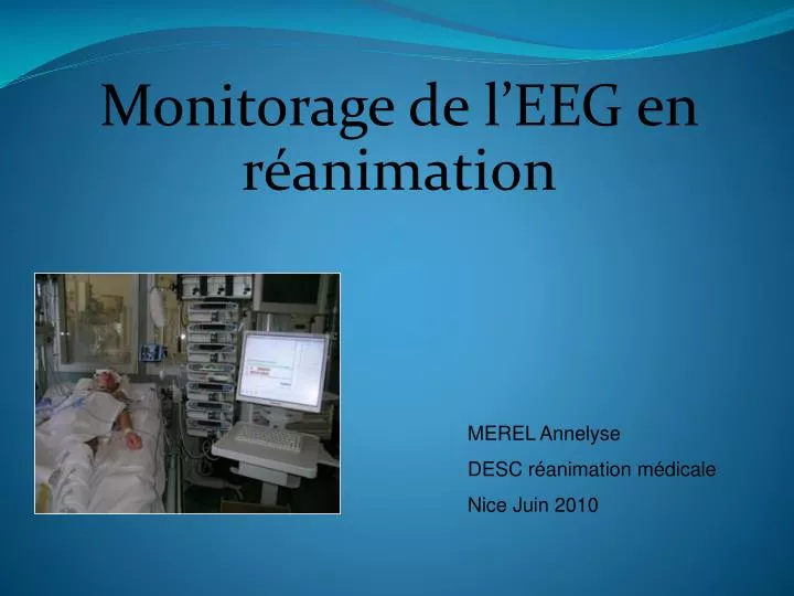 monitorage de l eeg en r animation