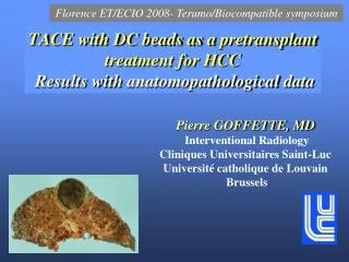 TACE with DC beads as a pretransplant treatment for HCC Results with anatomopathological data