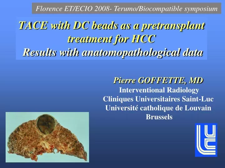 tace with dc beads as a pretransplant treatment for hcc results with anatomopathological data