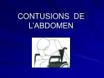 CONTUSIONS DE L’ABDOMEN - slide 1