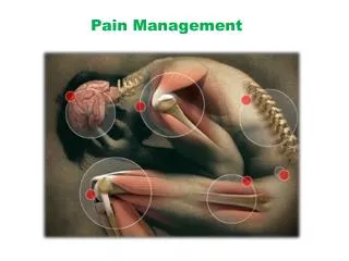 Pain Management