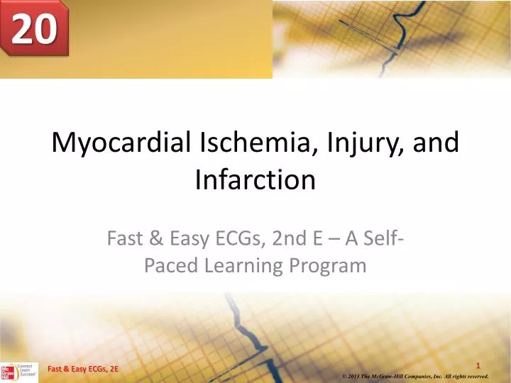 myocardial ischemia injury and infarction