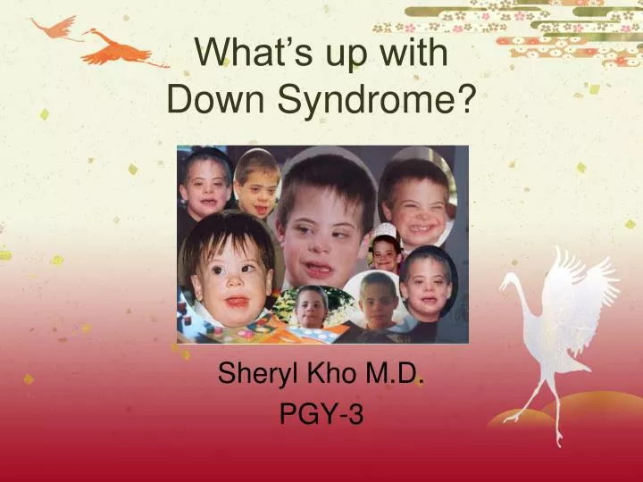what s up with down syndrome