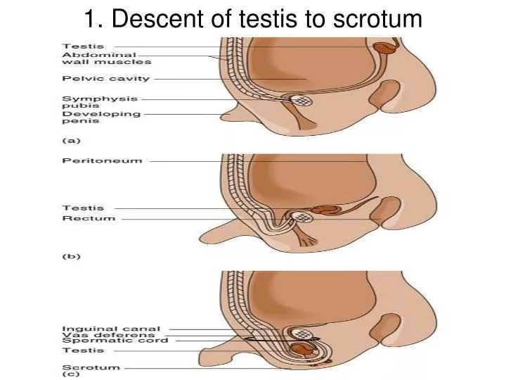 1 descent of testis to scrotum
