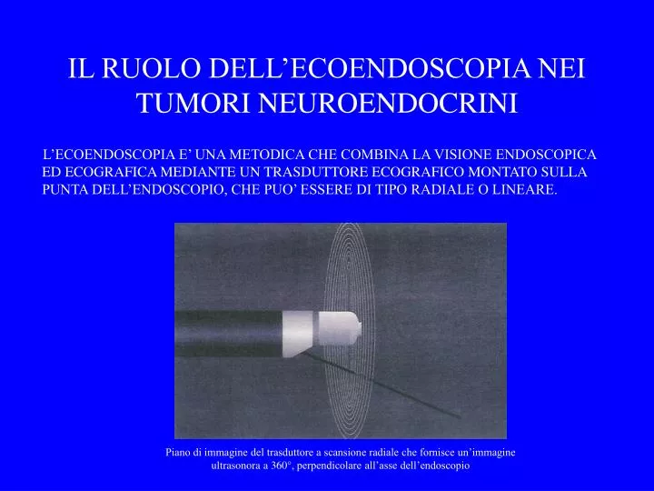 il ruolo dell ecoendoscopia nei tumori neuroendocrini