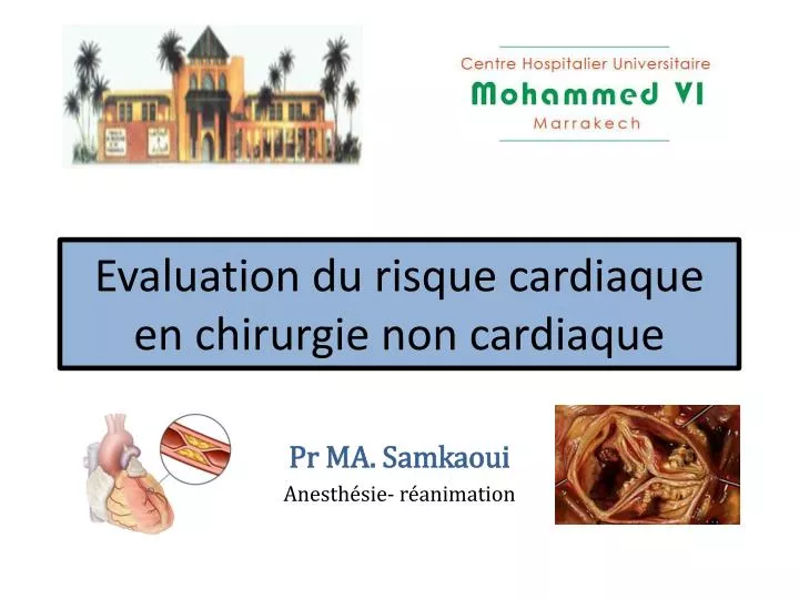 evaluation du risque cardiaque en chirurgie non cardiaque
