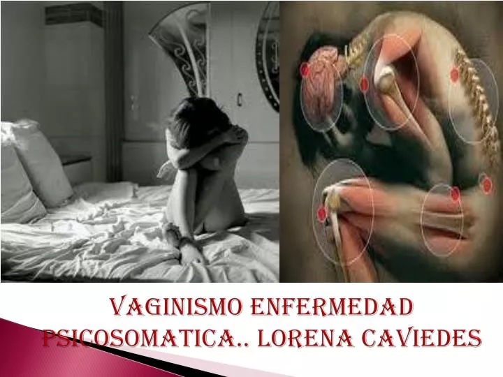 vaginismo enfermedad psicosomatica lorena caviedes