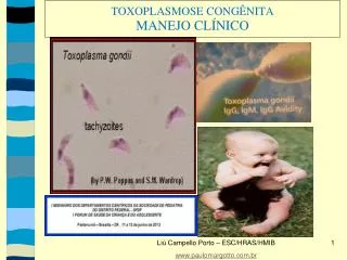 toxoplasmose cong nita manejo cl nico