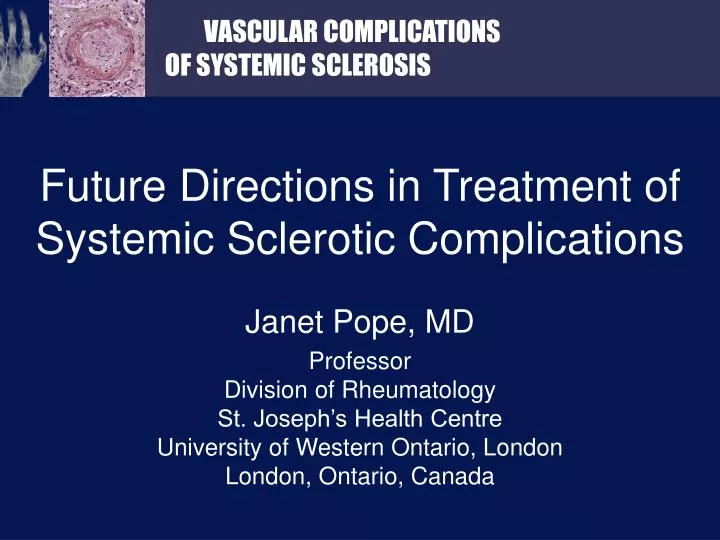 future directions in treatment of systemic sclerotic complications