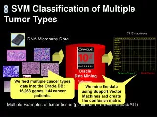 Multiple Examples of tumor tissue (public data from Whitehead/MIT)