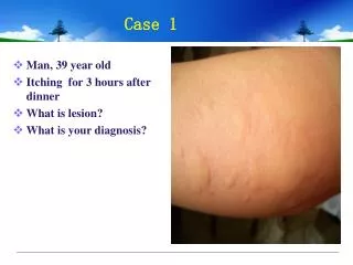 Man, 39 year old Itching for 3 hours after dinner What is lesion? What is your diagnosis?