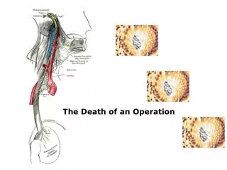 The Death of an Operation