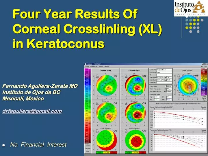 four year results of corneal crosslinling xl in keratoconus