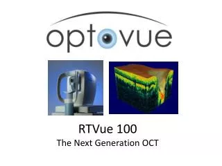 RTVue 100 The Next Generation OCT