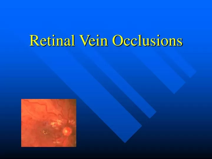 retinal vein occlusions