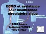 ECMO et assistance pour insuffisance circulatoire aigue - slide 1