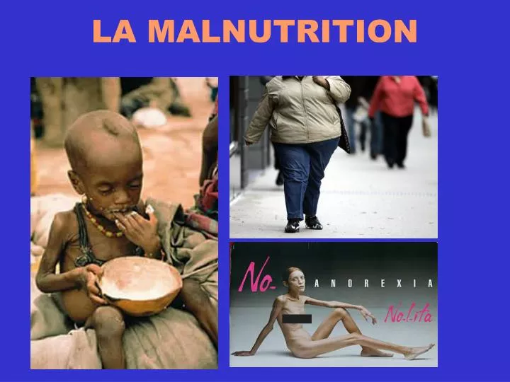 la malnutrition